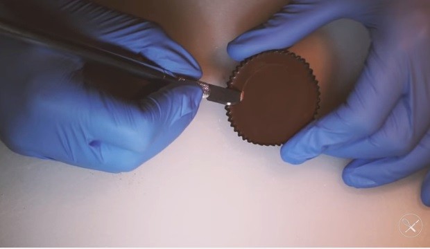 Reeses Peanut Butter Cup Oreo Surgery