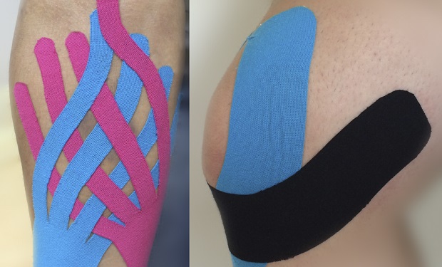 KinesioTaping